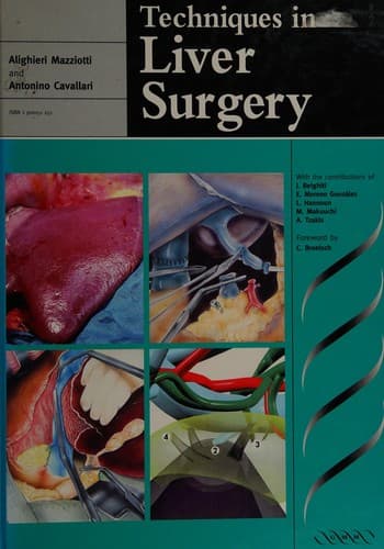 Techniques in liver surgery