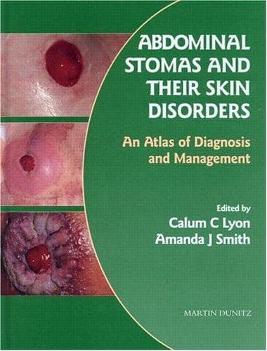 Abdominal stomas and their skin disorders