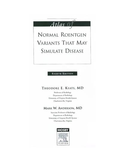 Atlas of normal roentgen variants that may simulate disease